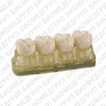 TOOTH MODEL WTYPE  модель из 4х зубов, демонстрирующая стадии кариеса