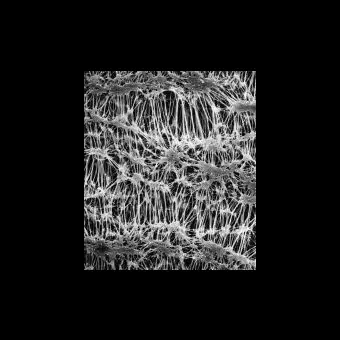 Фильтр, Флуоропор, d пор 1,0 мкм, d мембраны 37 мм, 100 шт., Merck Millipore, FALP03700