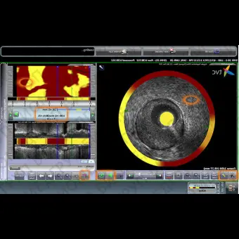 Программное обеспечение для кардиологии TVC Composite Image