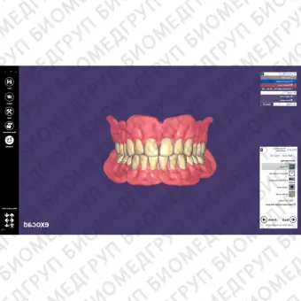 Exocad Full Denture Module  модуль для создания полносъемных протезов