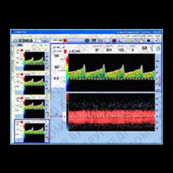 Трансчерепной доплер DigiLite