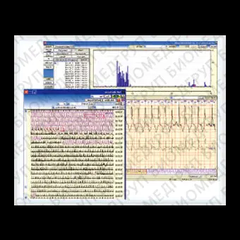 Медицинское программное обеспечение Cardy Analyzer05