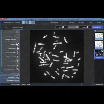 ПО для автоматического анализа хромосом, кариотипирования, АргусKaryo, АргусСофт, ARGUS  KARYO