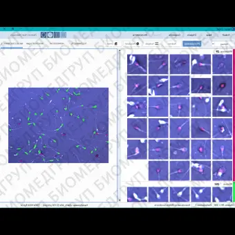 Спермоанализатор на базе ПО для компьютерного анализа эякулята, АргусCASA, АргусСофт, ARGUS  CASA 4