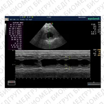 Sonoscape S6V Аппарат УЗИ