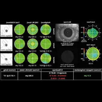 Роговичный топограф KR1W