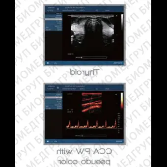 Переносной ультразвуковой сканер P3