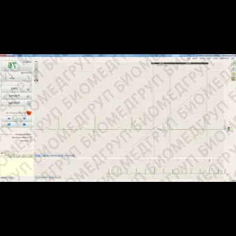 Электрокардиограф для спокойного состояния BTL CardioPointECG C600