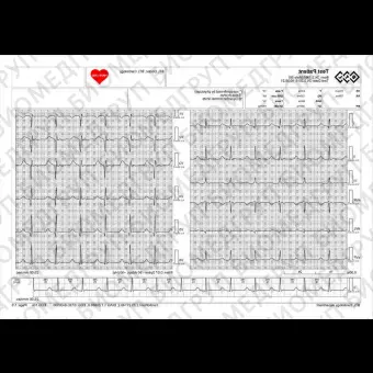 Электрокардиограф для спокойного состояния BTL CardioPointECG C600