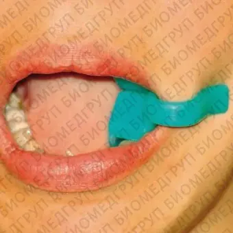 Прибор для открывания рта для стоматологии MiraholdBlock