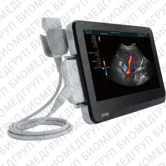 Переносной ветеринарный ультразвуковой сканер T3300v