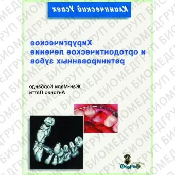 Книга Хирургическое и ортодонтическое лечение ретинированных зубов / Ж. Корбендо