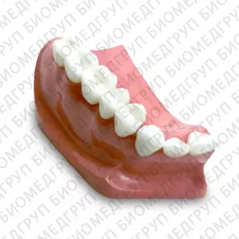 DM23 модель верхней челюсти для демонстрации установки зубного моста