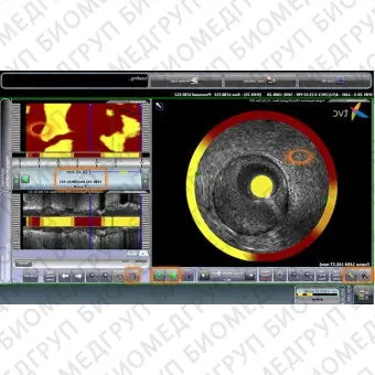 Программное обеспечение для кардиологии TVC Composite Image