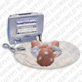 Монитор пациента для ЭЭГ Olympic CFM 6000