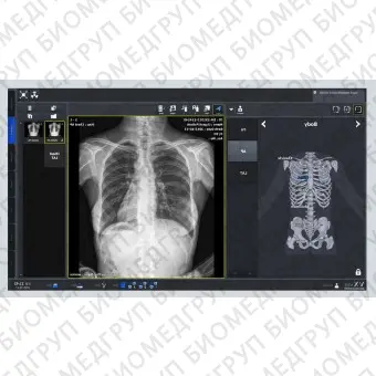 Программное обеспечение рентгенографии VXvue with PureImpact