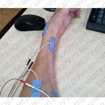 Электромиостимулятор для восстановления после операций, травм и инсультов Cefar Rehab X2