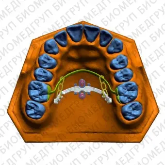 Конический зубной имплантат LIM