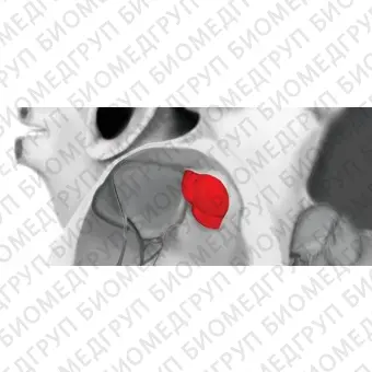 Аортальный биопротез клапана сердца Myval