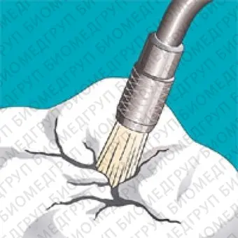 Sonicflex clean brush 6  насадкащетка валик большой для чистки зубов