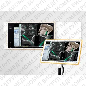 Система хирургической навигации для нейрохирургии Kick