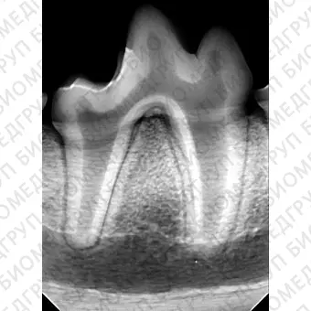 Программное обеспечение для обработки снимков зубов в ветеринарии scil DDXR
