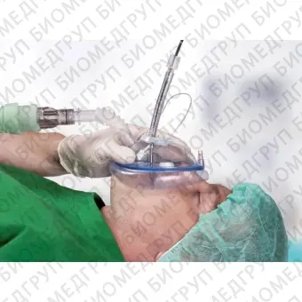 Вентиляционная маска для эндоскопии 3040000