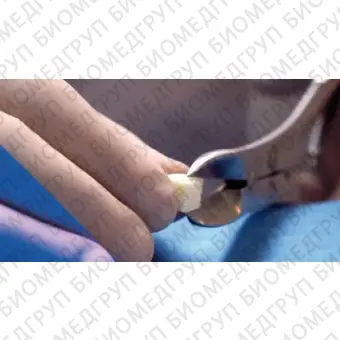 Костный заменитель ксенотрансплантат Smartbone