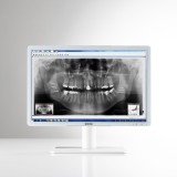 Стоматологический монитор MDRC-2224 WP