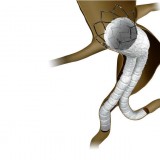 Стент-трансплантат для брюшной аорты INCRAFT™ AAA