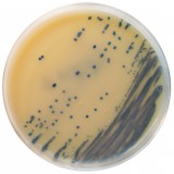 Staphylococcus aureus MRSA