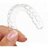 Зубная форма для выравнивания зубов ClearGuide™