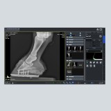 Программное обеспечение рентгенографии VXvue with PureImpact™